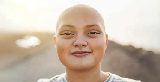 Cómo enfrentar la pérdida de cabello por quimioterapia: Guía de apoyo y autocuidado